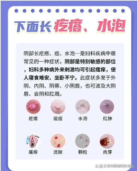 私处长小肉揪是什么原因