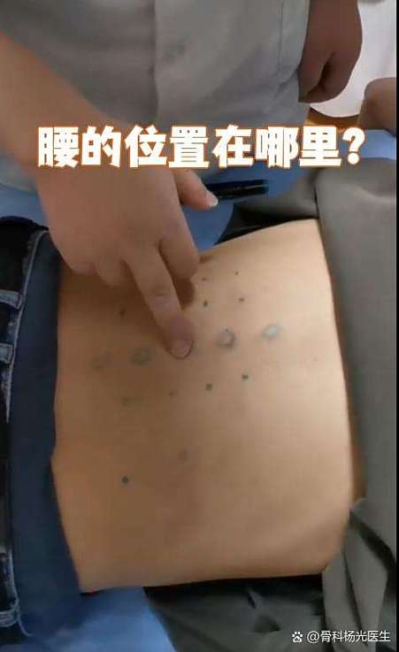 TK腰肋骨