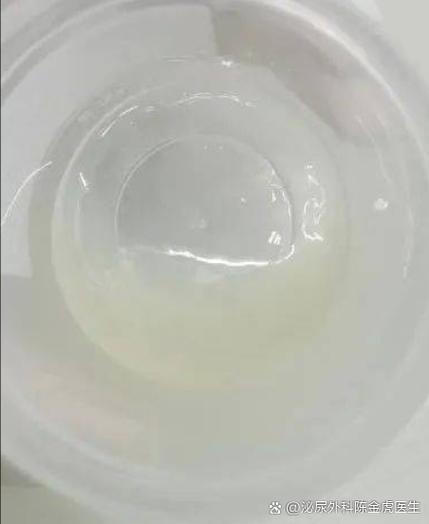 无精子