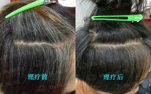白发变黑最简单的方法