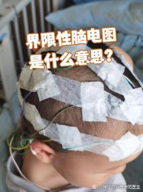 界线性婴儿脑电图枕区节律偏慢