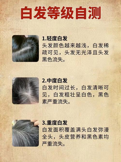 白发多怎么调理成黑发