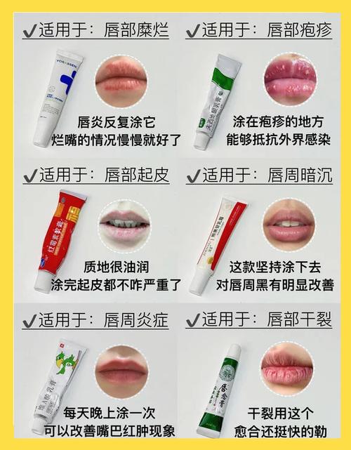 唇炎10个小妙招