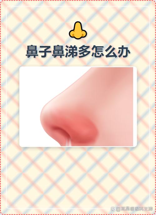 鼻涕多是啥病