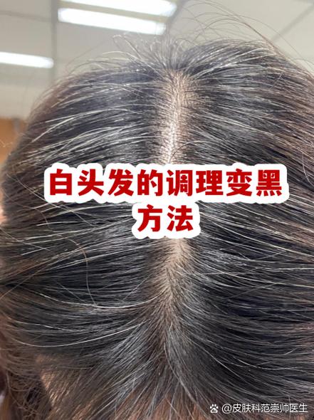 头发白怎么才能调理变黑