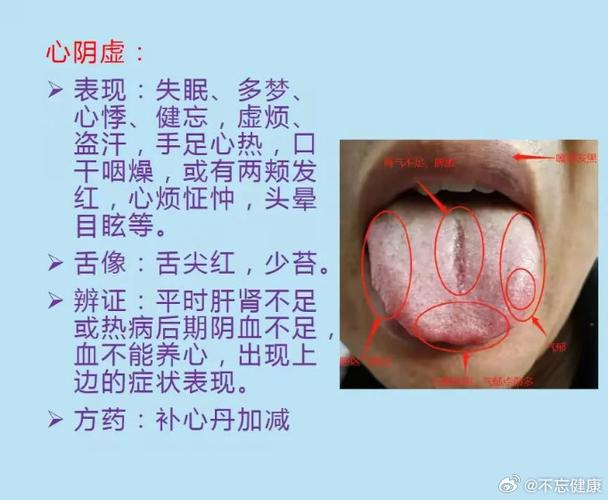 中医不号脉只看舌诊准吗
