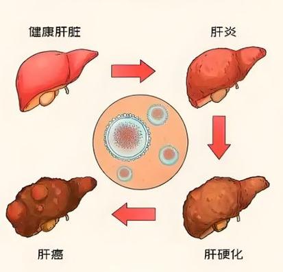 乙肝吃葡萄好不好