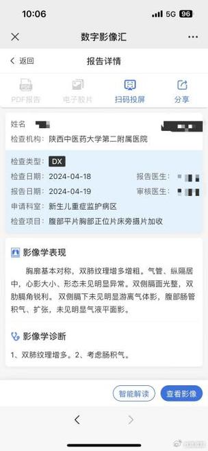 影像云胶片查询