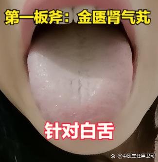 网上中医靠看舌头开药可信吗