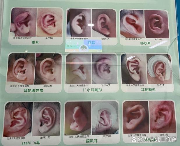 为什么没插耳机却显示