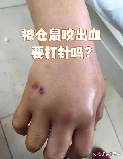 给仓鼠咬到有毒吗