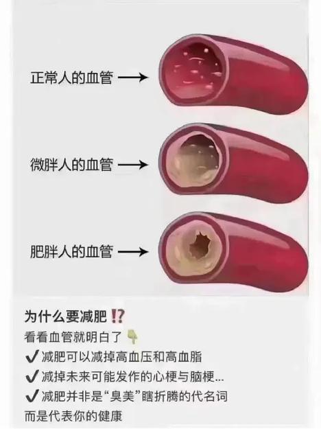 体寒虚胖的人怎么减肥最快