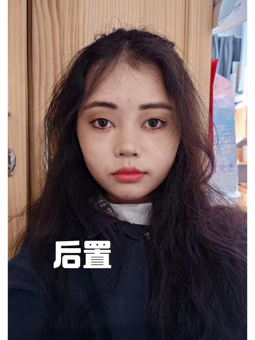 前置好看后置丑为啥