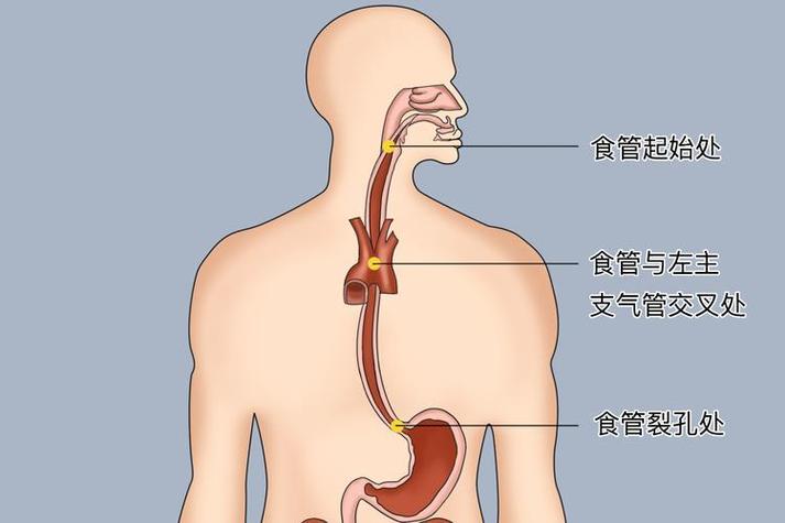 人体食道部位图