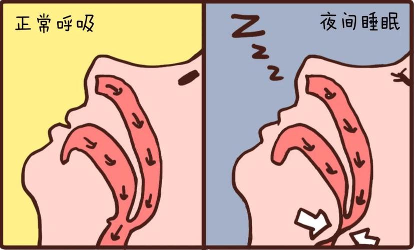 经常晚上睡觉被吵醒的危害