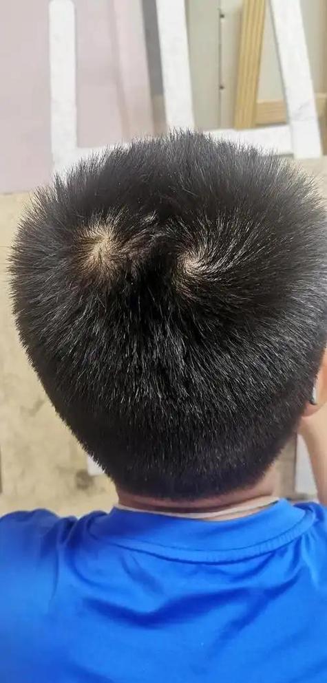 头顶两个旋额头一个旋的男孩命好吗