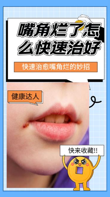 嘴角烂了怎么快速治好