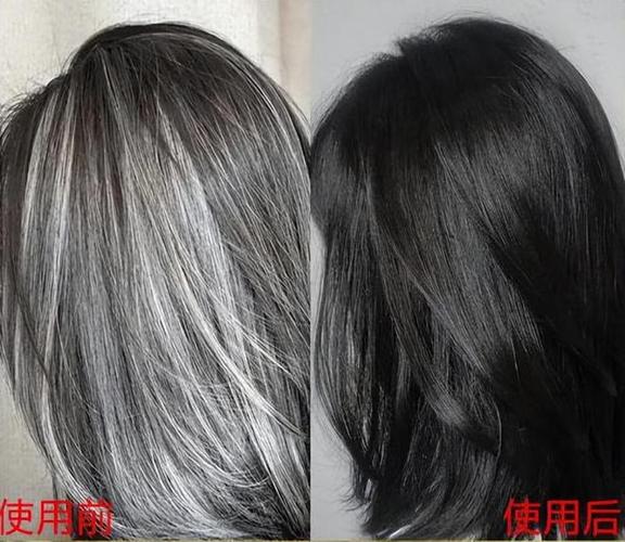 白发能养黑是真的吗