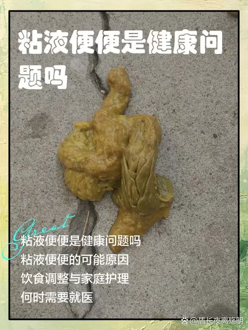 大便有脓状粘液