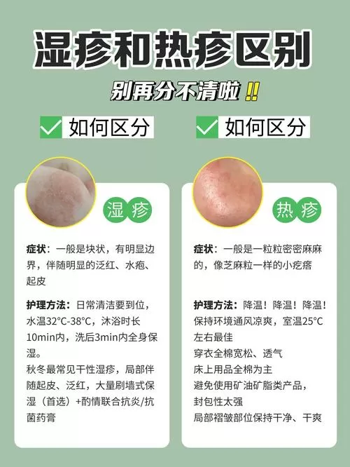 红疹和湿疹图片对照