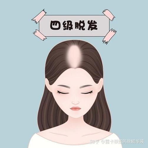 发旋头发稀疏怎么改善