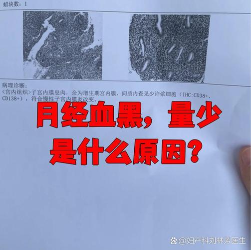 月经来了三天褐色不见血蓝色旧版无广告