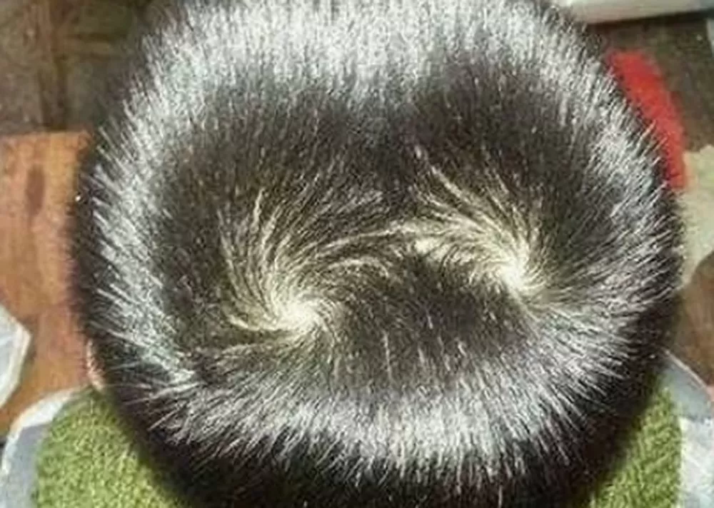 头上双旋男孩命运