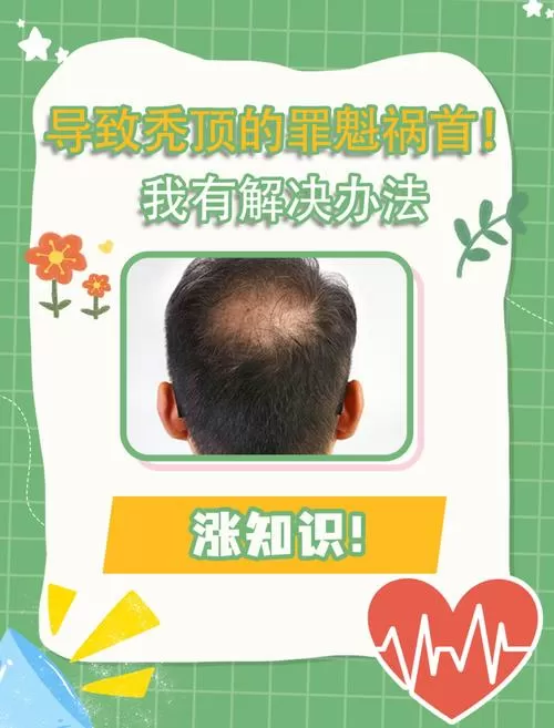秃顶有什么办法恢复正常