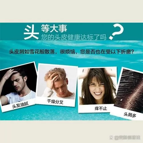 头皮流透明水要警惕