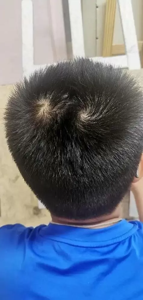 前额两个旋,头顶一个旋