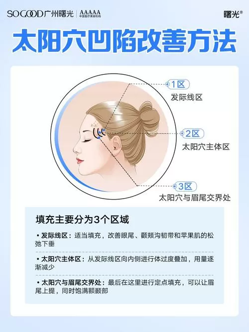 太阳凹陷怎么恢复饱满